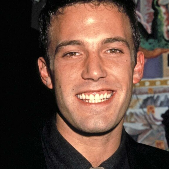 Purukalusto paljasti Lindsay Lohanin huumeiden käytön, Ben Affleckin hampaat häiritsivät Armageddon-ohjaajaa – Hollywood-tähdet sijoittavat tuhansia euroja häikäisevään hymyyn! Ben Affleck