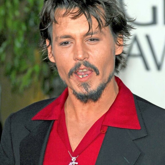 Purukalusto paljasti Lindsay Lohanin huumeiden käytön, Ben Affleckin hampaat häiritsivät Armageddon-ohjaajaa – Hollywood-tähdet sijoittavat tuhansia euroja häikäisevään hymyyn! Johnny Depp