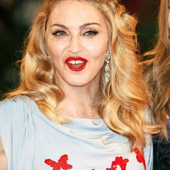 Purukalusto paljasti Lindsay Lohanin huumeiden käytön, Ben Affleckin hampaat häiritsivät Armageddon-ohjaajaa – Hollywood-tähdet sijoittavat tuhansia euroja häikäisevään hymyyn! Madonna