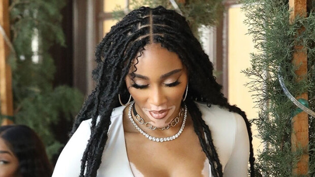 Uskomaton kaula-aukko ja kilometrisääret! Huippumalli Winnie Harlow käänsi päät ravintolassa - paparazzikuvat! Winnie Harlow