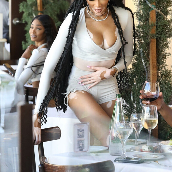 Uskomaton kaula-aukko ja kilometrisääret! Huippumalli Winnie Harlow käänsi päät ravintolassa - paparazzikuvat! Winnie Harlow