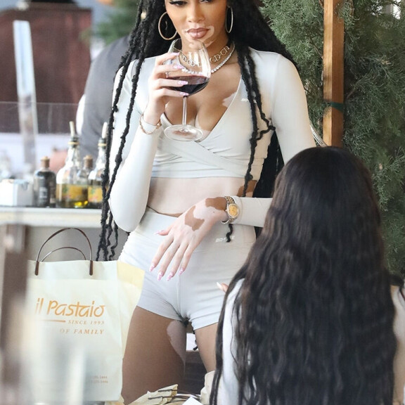 Uskomaton kaula-aukko ja kilometrisääret! Huippumalli Winnie Harlow käänsi päät ravintolassa - paparazzikuvat! Winnie Harlow