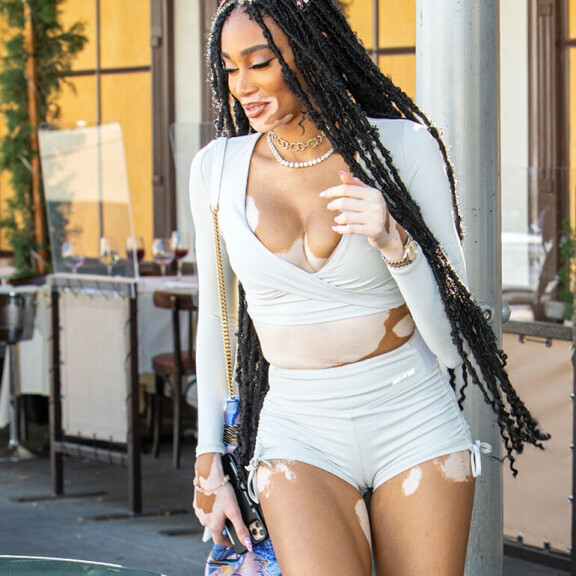 Uskomaton kaula-aukko ja kilometrisääret! Huippumalli Winnie Harlow käänsi päät ravintolassa - paparazzikuvat! Winnie Harlow