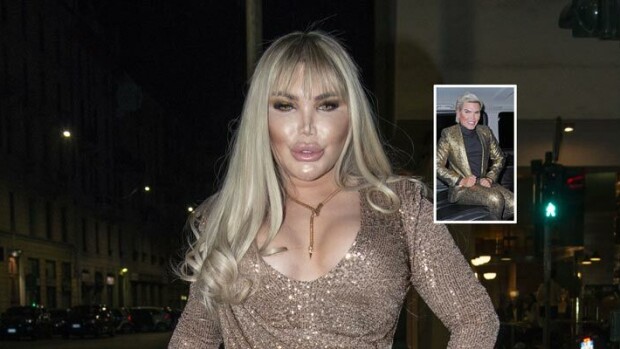 Ihmis-Ken on nyt ihmis-Barbie! Rodrigo Alves korjasi sukupuolensa – vatsalihasimplantti vaihtui silikonirinnoiksi! Rodrigo Alves korjasi sukupuolensa