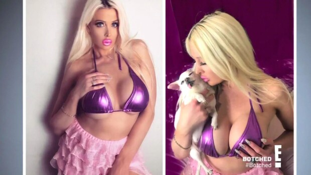 Norjan suurimmat rinnat omaava 'Bimbonukke' Sindy Starlet halusi nenäleikkauksen - lääkärit uhkasivat poistaa rintaimplantit! Sindy