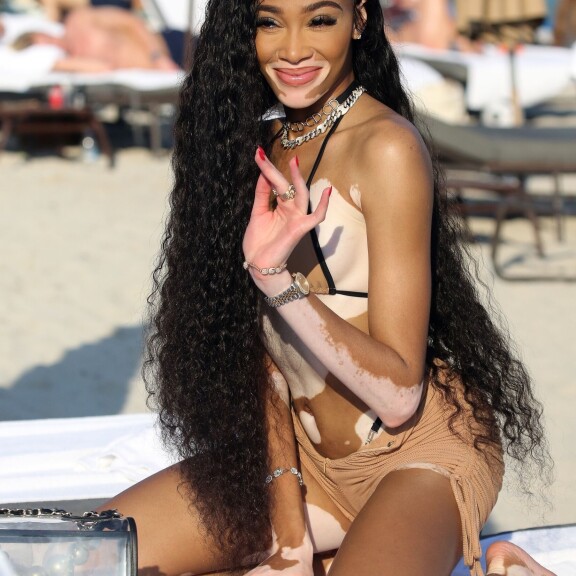 Yksi maailman upeimmista naisista! Pigmenttipoikkeamallaan erottuva Winnie Harlow keimaili bikineissä - katso kuumat rantakuvat! dg