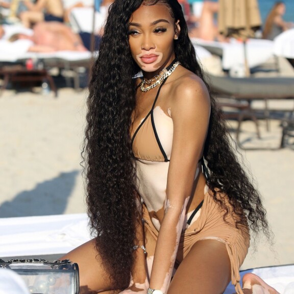 Yksi maailman upeimmista naisista! Pigmenttipoikkeamallaan erottuva Winnie Harlow keimaili bikineissä - katso kuumat rantakuvat! srjy