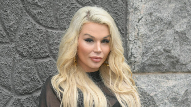 ”Leukaperieni iho roikkuu!” Nimeään vaihtanut kohukaunotar Sofia Immonen turvautui kauneusoperaatioon – kuvat! Sofia Hult turvautui kauneustoimenpiteeseen.