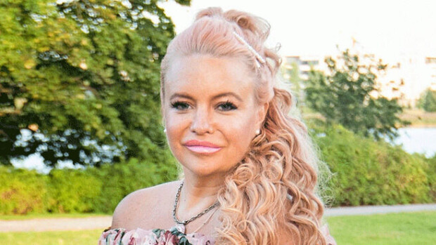 Johanna Tukiainen jakoi itsestään rehellisen kuvaparin: 'Olin punaisena ja turvonneena kuolemassa viinamyrkytykseen' - Ennen ja nyt! Johanna