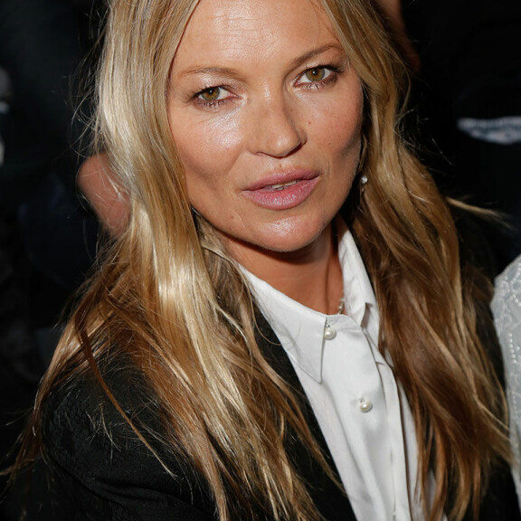 Beyoncé 40 vuotta - tiesitkö näitä faktoja popparista? Nukkui iljettävän lemmikkieläimen kanssa ja kärsii ikävästä allergiasta! Kate Moss