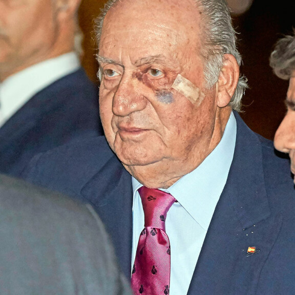 Hovi vaikeni! Espanjan ex-kuningas Juan Carlos näyttäytyi silmä mustana – kuva! Juan Carlos