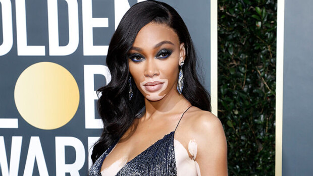 Oijoi! Huippumalli Winnie Harlow, 26, hurmaa topless-paparazzikuvissa Meksikossa - katso! Winnie Harlow
