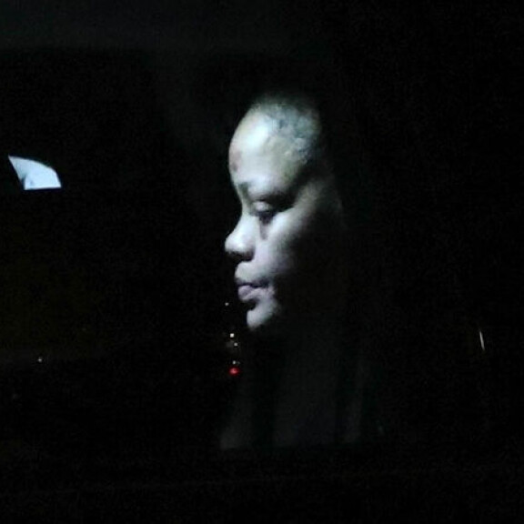 Rihanna teloi kasvonsa kaaduttuaan sähköpotkulaudalla - pysäyttävät kuvat tallentuivat paparazzin kameraan Rihanna