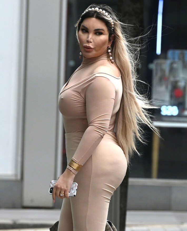 Entinen ihmis-Ken Jessica Alves käänsi päät hullunkurisessa nänniasussa uuden peppuoperaation jälkeen: liki kaikki näkyy kankaan alta - paparazzikuvat! rodrigo alves