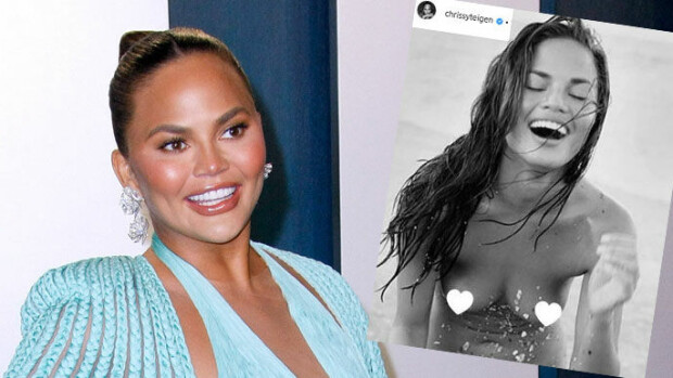 Huippumalli Chrissy Teigen poistaa silikonirintansa - kertoi uutisen yläosattomalla kuvalla: 'Olen kyllästynyt niihin!' Chrissy Teigen