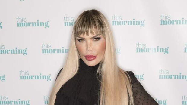 Kuvat hurjasta muodonmuutoksesta! Näin sukupuolensa korjannut Rodrigo ”ihmis-Ken” Alves rahoitti kymmenet kauneusleikkaukset! Rodrigo Alves korjasi sukupuolensa