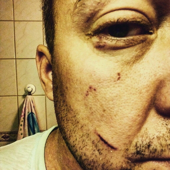 Jukka-Pekan naama oli rujon näköinen pahoinpitelyn jäljiltä. Jukka-Pekan naama oli rujon näköinen pahoinpitelyn jäljiltä.