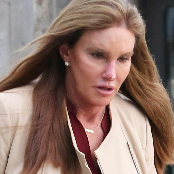 Mitä ihmettä Caitlyn Jennerin nenälle tapahtui?! Tuore kuva hämmentää – katso! Caitlyn Jenner