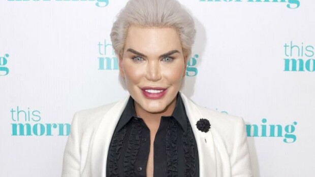 Ihmis-Ken on käyttänyt 450 000 euroa kauneusleikkauksiin: Kaikki alkoi koulukiusaamisesta – nyt Rodrigo Alves, 34, ei pysty hengittämään nenän kautta! Ihmis-Ken jatkaa vaarallisia leikkauksia.