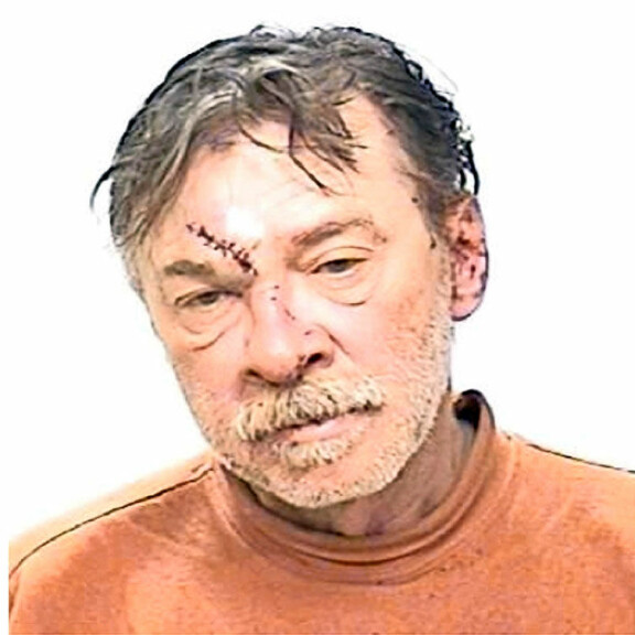 Anthony on ollut usein pidätettynä juoppokärhämien seurauksena.  Anthony on ollut usein pidätettynä juoppokärhämien seurauksena. 