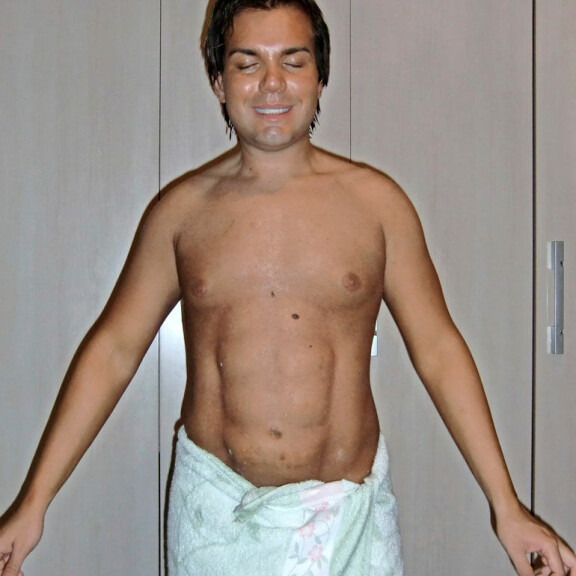 Rodrigo hankki vatsalihaksia muistuttavat implantit useita vuosia sitten. Rodrigo hankki vatsalihaksia muistuttavat implantit useita vuosia sitten.