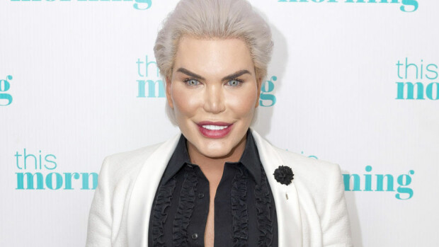 Ihmis-Ken esitteli uutta tiimalasivartaloaan - ja yök, poistettuja kylkiluitaan! Katso kuvat! Rodrigo Alves