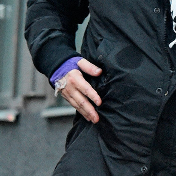 Sokkikuvat! Jari Sillanpään rähjäinen olemus hämmästyttää: tupakoi sairaalan edessä autuas virne kasvoillaan – kädestä törrötti kanyyli! Jari Sillanpää