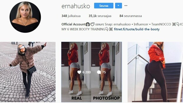 Fitnessmalli-kisan finalisti julkaisi pepustaan ennen ja jälkeen -kuvat - someraivo puhkesi: ”Oletko tosissasi?” Erna Huusko