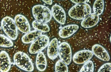 Spermassa voi vaania ebola tai zikavirus - mutta se ei välttämättä leviä!