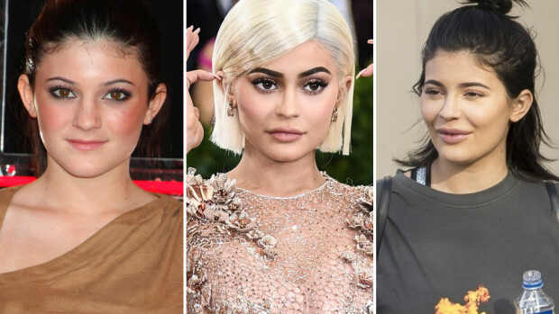 Huhhuh, Kylie Jenner, 20, pilaa kasvonsa plastiikkakirurgialla - tuore kuva järkyttää! Kylie Jennerin muodonmuutos seitsemässä vuodessa