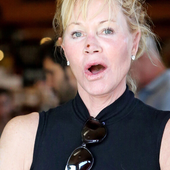 Auts! Melanie Griffithin nenä märkii! Katso kuvat! melanie Griffith katuu kasvoleikkauksiaan.