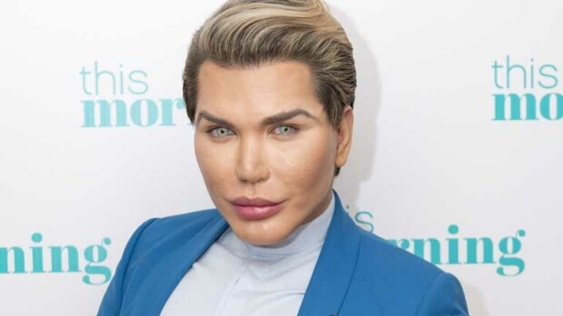 Ihmis-Ken jatkaa kauneusleikkausputkeaan: edessä 10:s nenäoperaatio, vaikka lääkäreiden mukaan nenä voi irrota kokonaan! Rodrigo Alves on ihmis-Ken.