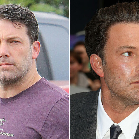 Turvautuiko Ben Affleck plastiikkakirurgin apuun – katso ja vertaa!