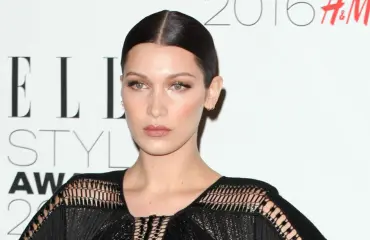 Kuvat ei herkille! Huippumalli Bella Hadidin harvinainen ulostulo – yli vuosikymmenen riivannut vaiva vei terveyden