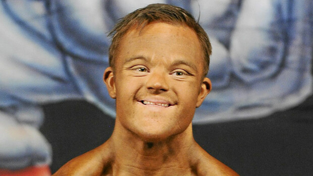 Downin syndrooma ei estänyt Collinia nousemasta kisalavalle - vau, mitkä muskelit! Downin syndrooma ei estänyt Collinia nousemasta kisalavalle - vau, mitkä muskelit!
