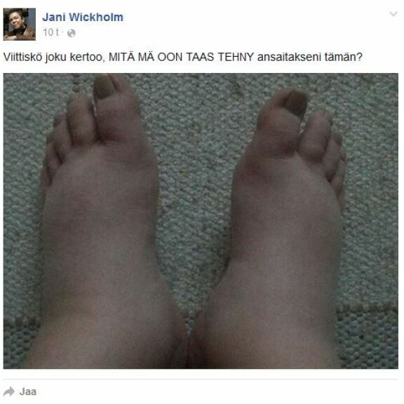 Jani Wickholm julkaisi järkyttävän kuvan sairaudestaan - katso!