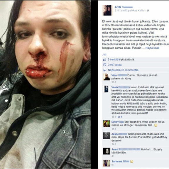 Ja taas: miesjoukko pahoinpiteli nuorukaisen Helsingissä - raju kuva!