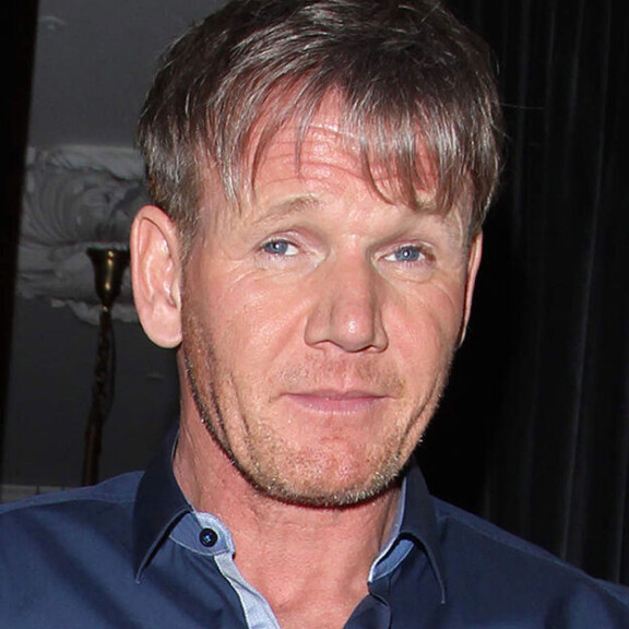 Kävitkö hiustensiirrossa, Gordon Ramsay - katso kuvat!