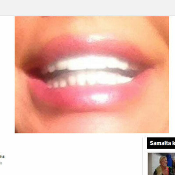 Tiina Jylhä: Supervalkoinen hymyni maksoi 20 000 euroa - katso!